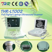 Thr-Lt002 Volldigitaler Ultraschallscanner